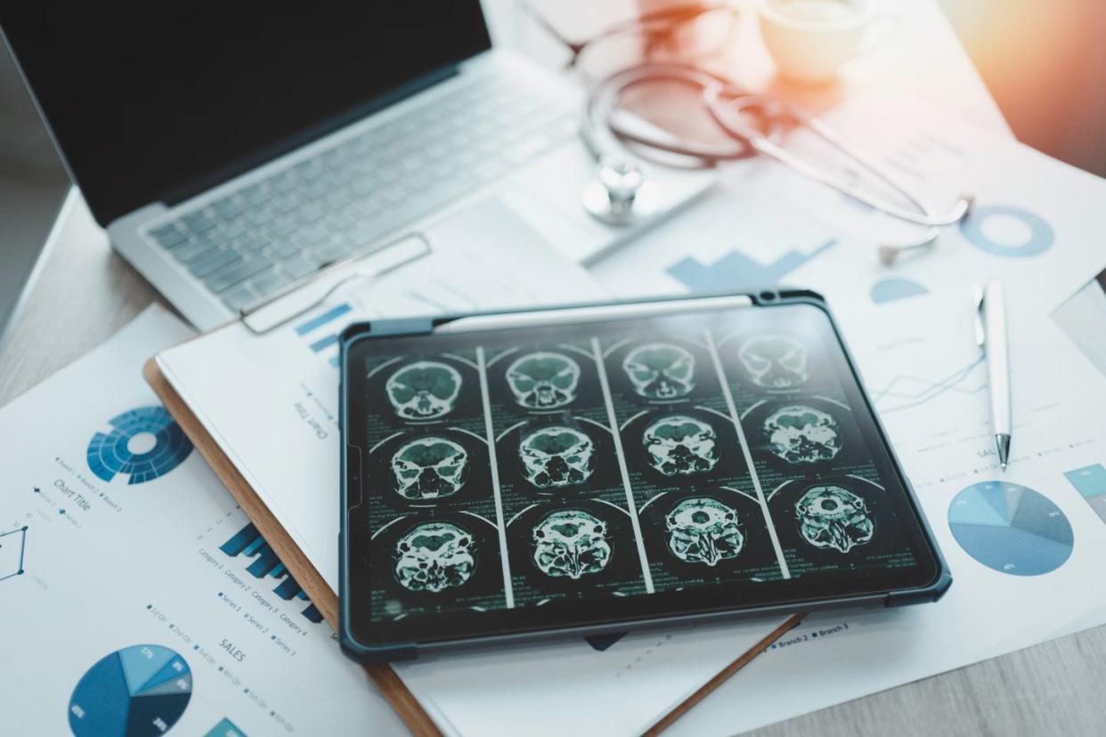 close up of a digital tablet with brain x ray on screen