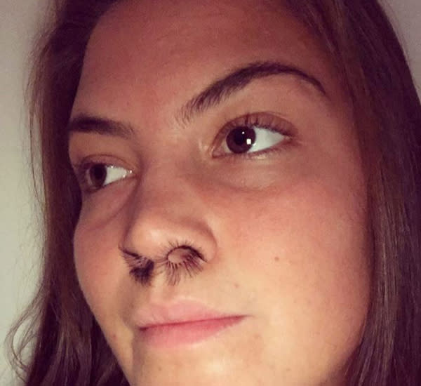 <p>Cette jeune Norvégienne a testé les extensions de poils de nez et elle adore cette nouvelle tendance.<br> Crédit photo : Instagram @sarknuds </p>