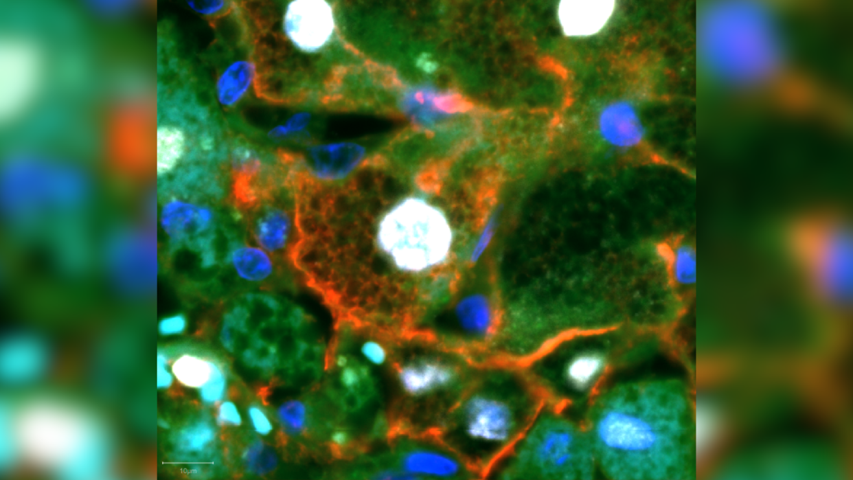  Microscope image in the center with a blurred version of the image layered behind. The image is of the newly-discovered liver repair cells. The nucleus of these cells can be seen in white and the cell membrane in red. There are also diffuse areas of green and blobs of blue dotted throughout the image, both dark blue and cyan. 