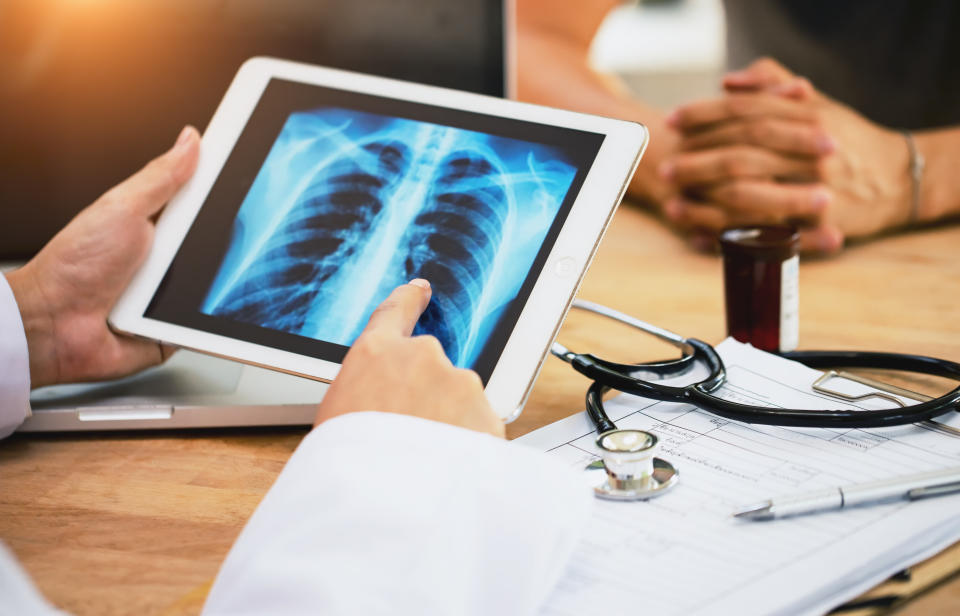 doctor pointing at a photo of an x-ray of lungs