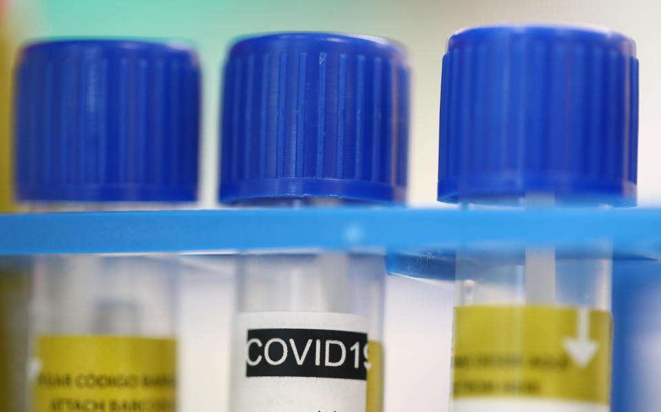 Tube tests stands in a holder as media visit the Microbiology Laboratory of the University Hospital, CHUV, during the coronavirus disease (COVID-19) outbreak in Lausanne, Switzerland, Monday, March 23, 2020. The Swiss authorities proclaimed on March 16, a state of emergency in an effort to halt the spread of the coronavirus and Covid-19 disease. The government declared that all entertainment and leisure businesses will shut down. Grocery stores, and hospitals will remain open and new border controls will be put in place. (Denis Balibouse/Keystone via AP, Pool)