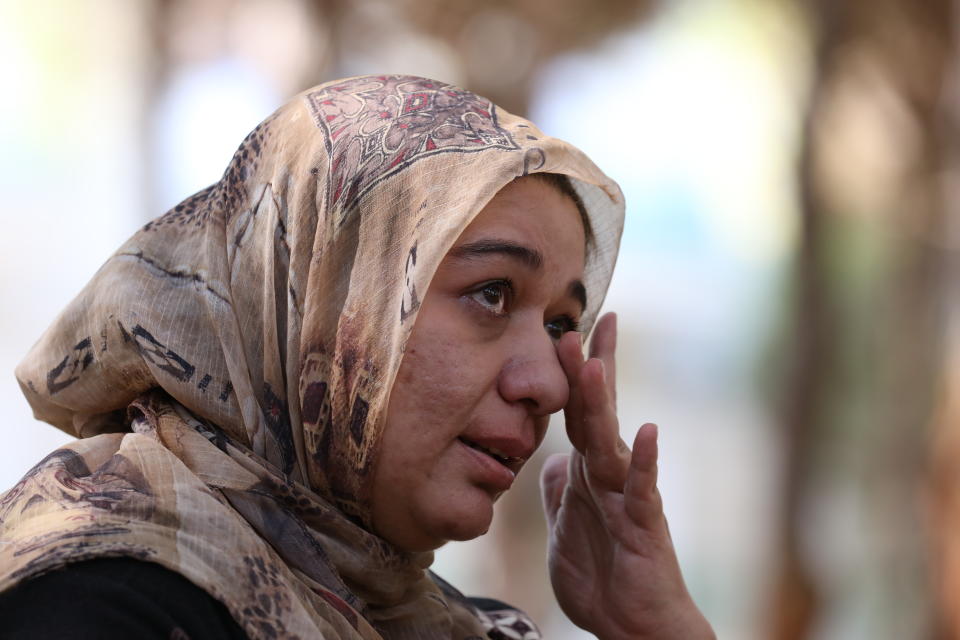 Ghazaal Habibyar, one of the 457 Afghan evacuees housed in Albania, wipes her eye as she speaks during an interview with The Associated Press, Sunday, Aug. 29, 2021. Habibyar, an Afghan evacuee, is now housed in a tourist resort in Albania. But she can hardly rest when remembering the difficulties she and her family faced getting onto the plane and leaving her homeland. Fearing the Taliban in power and the future of her children, she decided to leave, pledging to her 6-year-old son that they would come back one day to help Afghanistan rebuild. (AP Photo/Franc Zhurda)