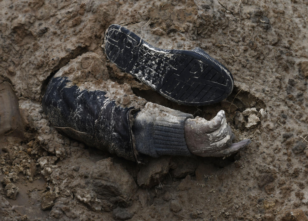 An arm and shoe are revealed at a mass grave in Bucha.