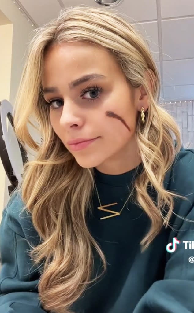 Annie Bonelli scar, TikTok screengrab