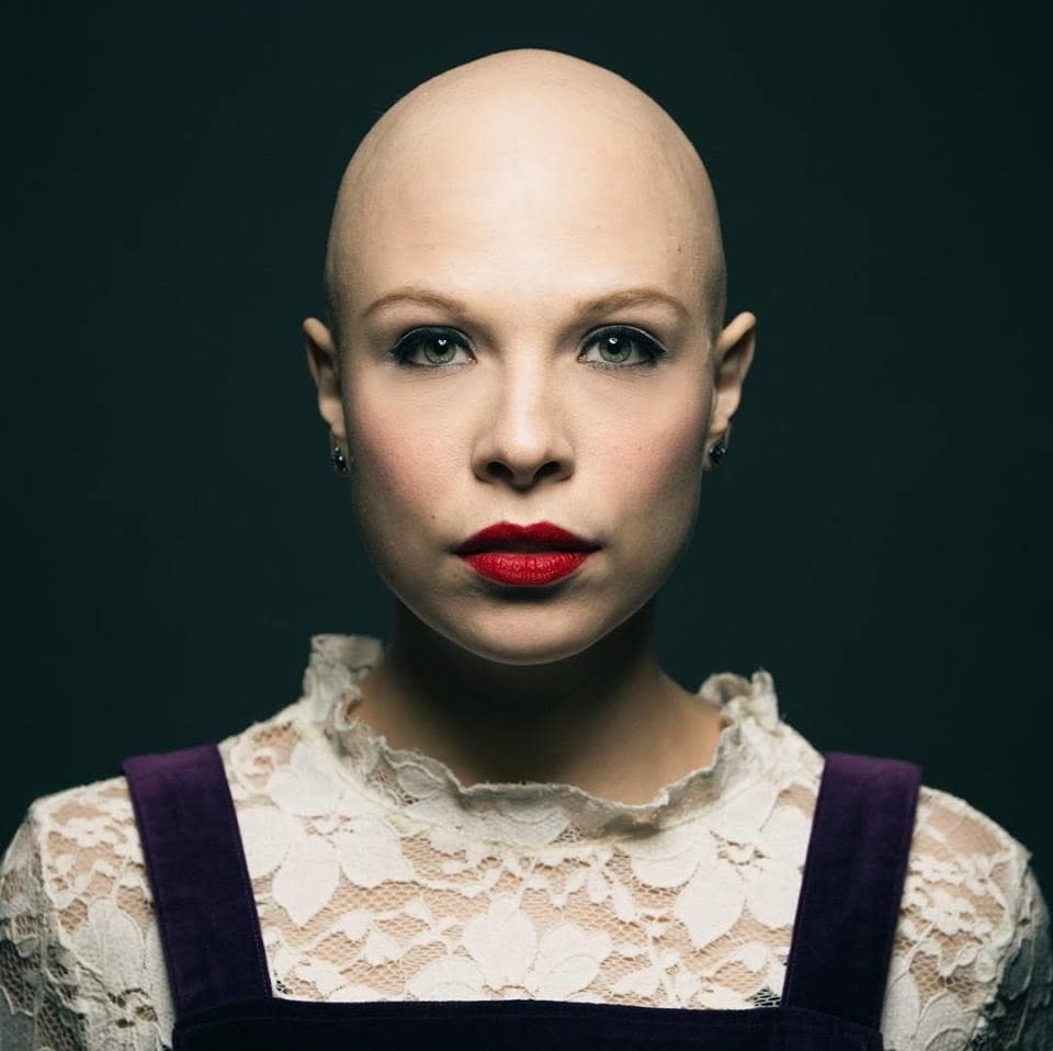 We spoke to size women about their experience with alopecia, and how their definition of beauty and self-confidence has changed.