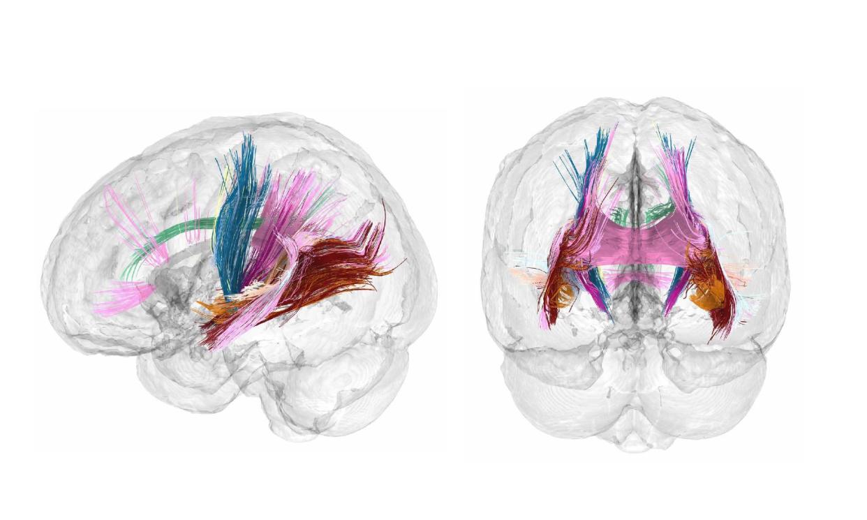 <span>White matter microstructure, a measure of the brain’s wiring, peaked at the end of the second trimester.</span><span>Photograph: Daniela Cossio</span>