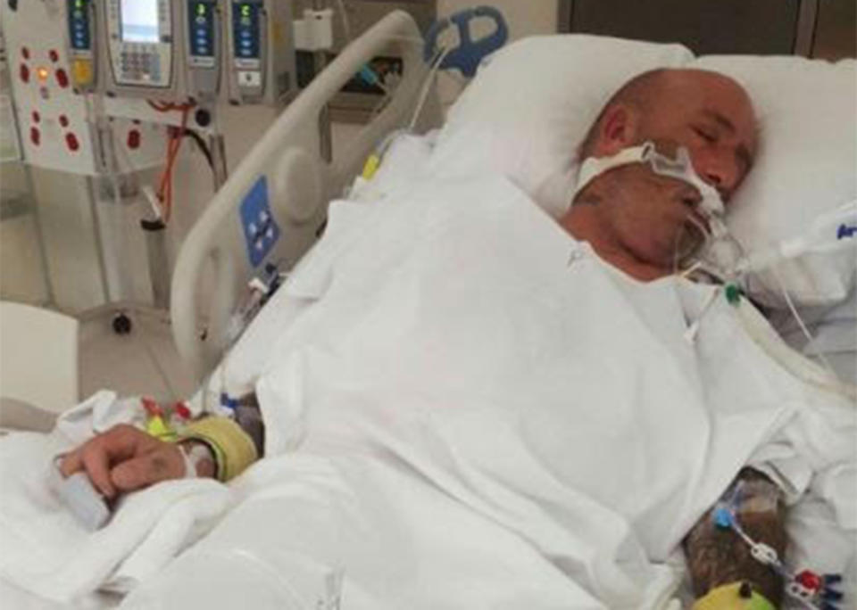 An Ararat man attacked while walking his dog has been left with permanent brain damage. 