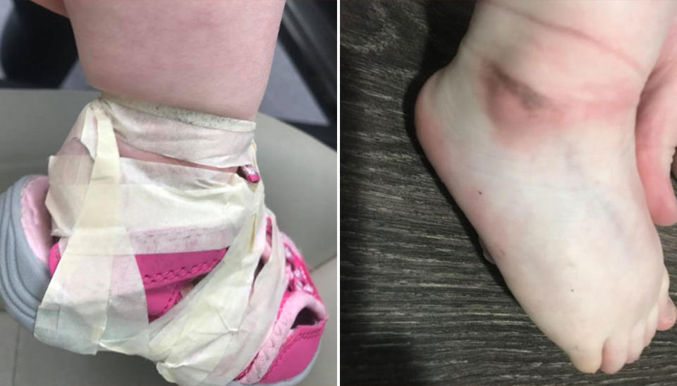 Jessica Hayes was left horrified after finding her little girl’s feet taped into her shoes after picking her up from childcare. Source: Facebook/ Jessica Hayes