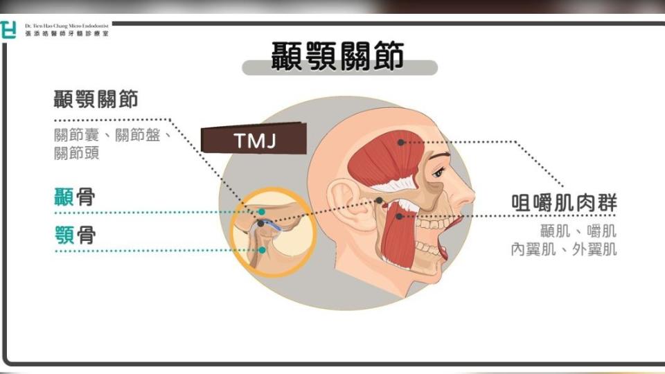 顳顎關節障礙。（圖／張添皓醫師的牙髓診療室）