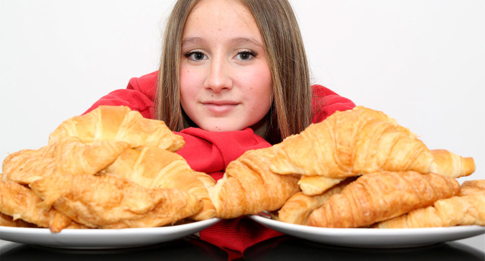 Ciarra Franco, 13, pictured with two plates of croissants, what she has been mainly eating for years. (Caters)