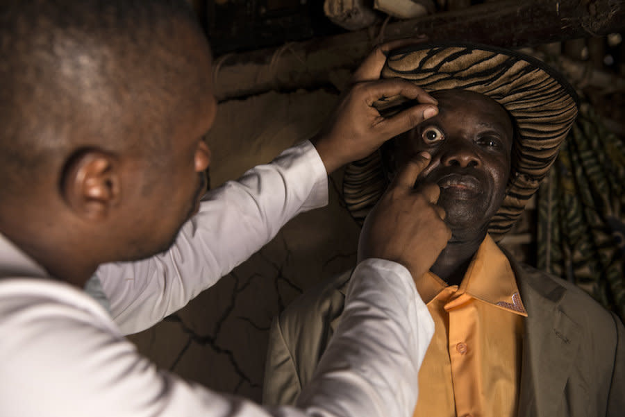 A doctor examines Baudoin for co-infections that could make it risky for him to take a drug used to fight elephantiasis. (Photo: Neil Brandvold/DNDi)