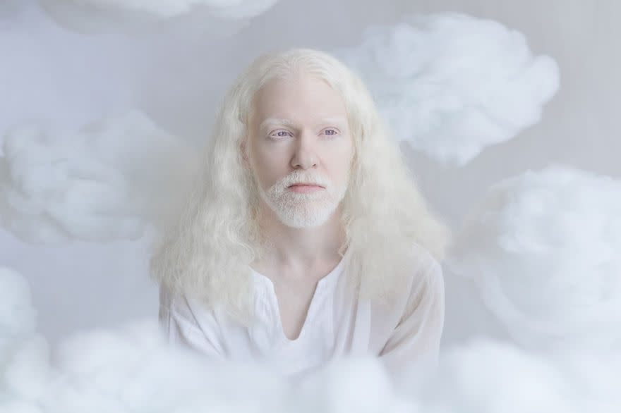 <p>La intención de esta artista israelí fue transmitir a través de estos retratos la belleza única de las personas albinas. </p>