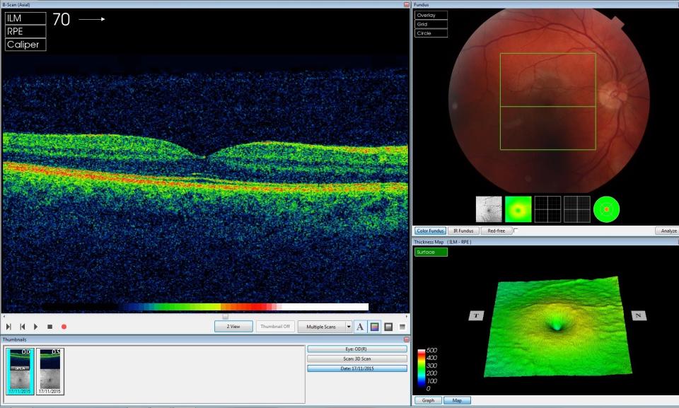 DeepMind has successfully developed a system that can analyze retinal scans