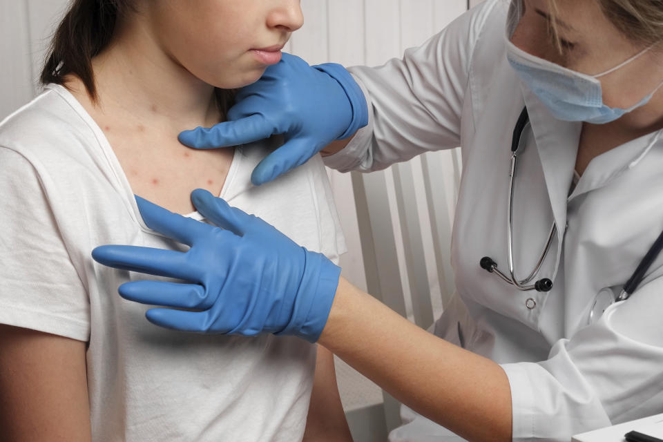 Doctor Checking Skin of Sick Girl. Kid with Red Rash being Examined at the Physician. Allergic Rash, Chicken pox, Monkeypox Symptoms on the Body of Child. Health Problem. Bacterial Infections, Disease. Small Child with Red Rash. Baby with Red Spots Blisters on the skin. Close up of Painful Rash. Health Problem. Rubella, Chickenpox, Scarlet fever, Measles. Bacterial Infections, Disease.