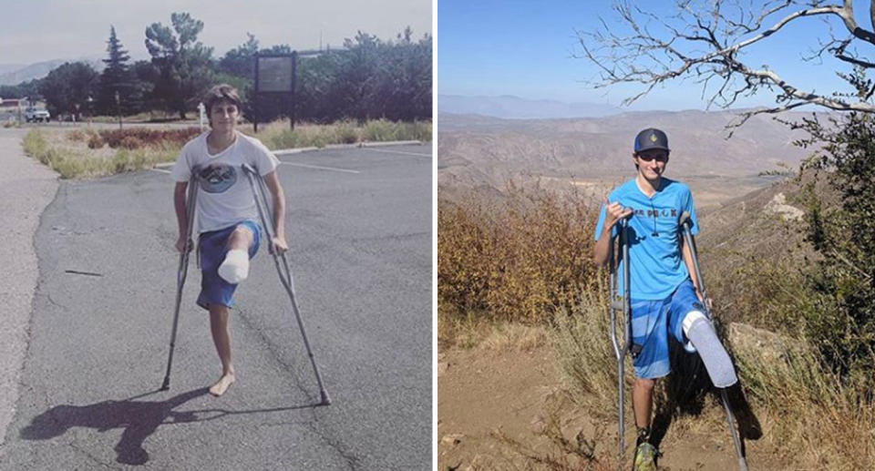 Elijah Reid pictured out and about on crutches after having his left leg amputated following hit-and-run.