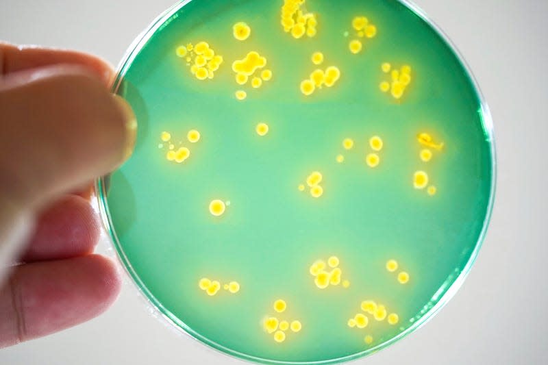 Vibrio bacteria being grown on a petri dish. - Image: Science Photo Library (AP)