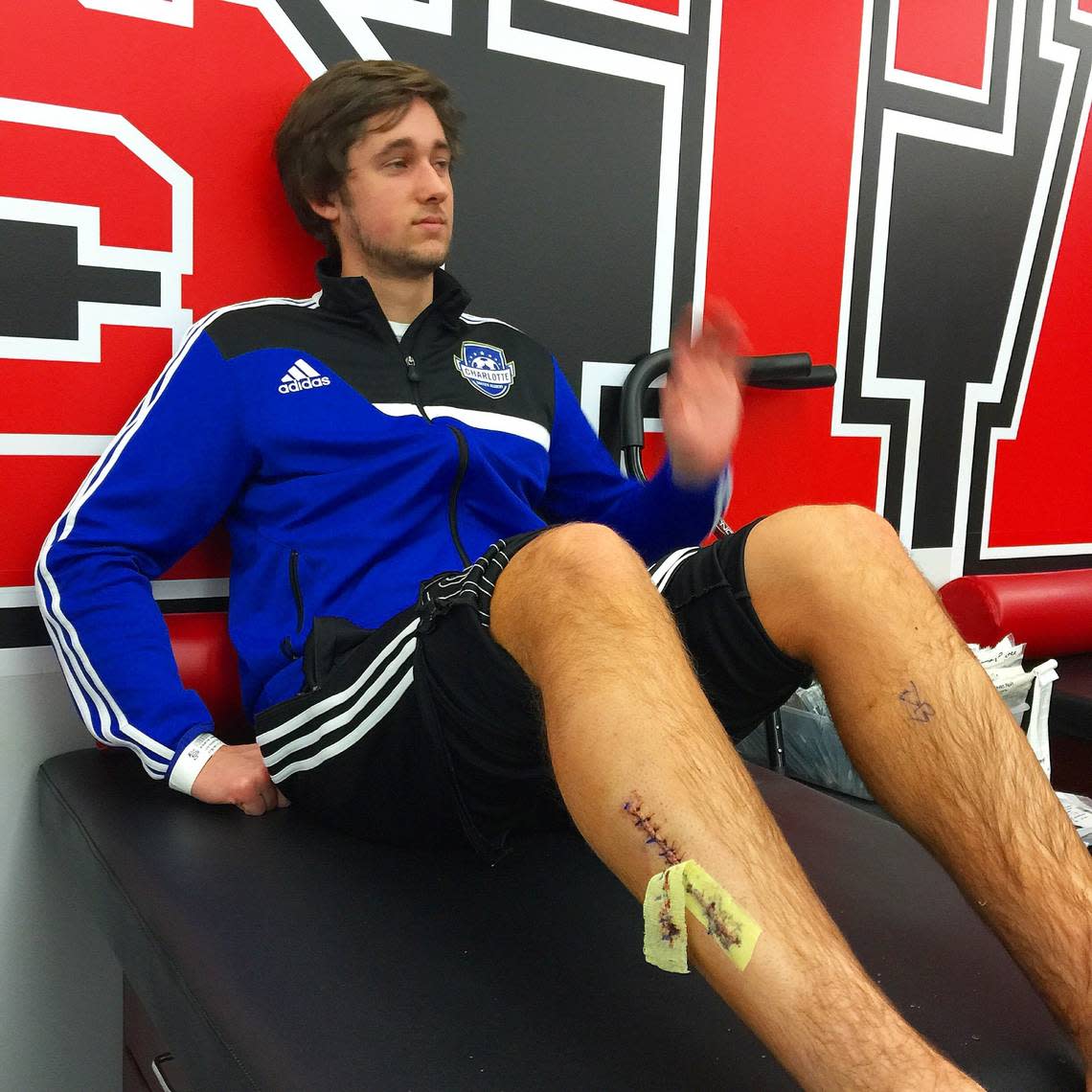 A March 29, 2015 photo shows Ben Locke, then a soccer player at N.C. State University, in a training room days after surgery for a leg injury.