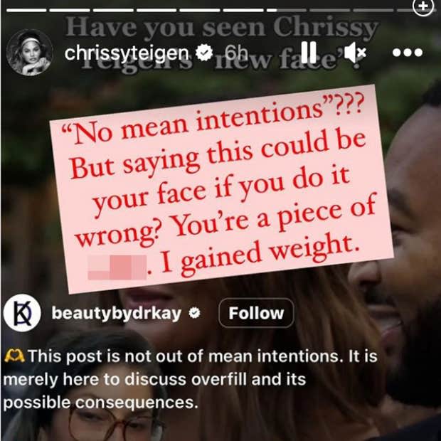 chrissy teigen defends herself against comments about her face weight gain