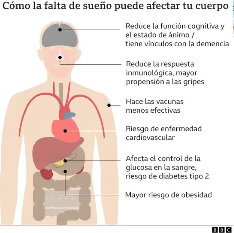 Cómo la falta de sueño puede afectar tu cuerpo 