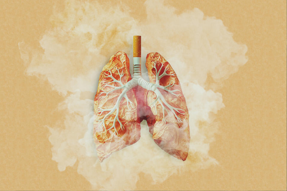 雖然一手煙及二手煙，被認為是引致肺癌的主要風險因素，但由於空氣污染等情況，非吸煙者患癌的機會亦增加。