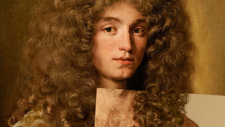 An exhbition poster shows a photograph of a man’s body hair fused with Flemish artist Jacob Ferdinand Voet’s 1689 painting<strong> </strong>“Portrait of a man.“ - Collection Jean-Louis Remilleux/Sotheby's/Art Digital