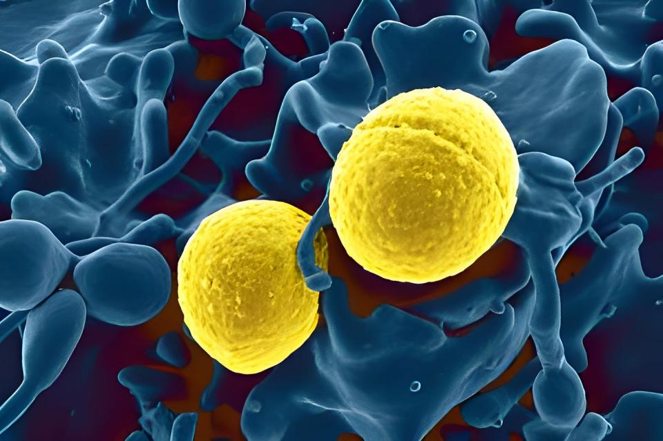 <span class="caption">Scanning electron micrograph of Staphylococcus aureus bacteria (gold) outside a white blood cell (blue)</span> <span class="attribution"><a class="link " href="https://www.gettyimages.com/detail/news-photo/scanning-electron-micrograph-of-staphylococcus-aureus-news-photo/1358939248?adppopup=true" rel="nofollow noopener" target="_blank" data-ylk="slk:BSIP/Universal Images Group via Getty Images;elm:context_link;itc:0;sec:content-canvas">BSIP/Universal Images Group via Getty Images</a></span>