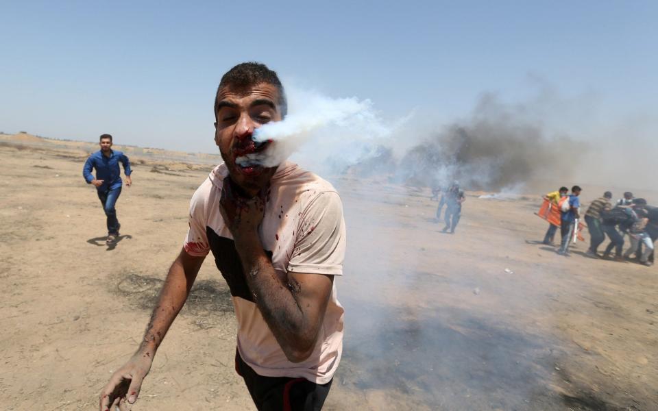 Wounded Palestinian demonstrator reacts as he is hit in the face with a tear gas canister fired by Israeli troops during a protest marking Jerusalem Day, at the Israel-Gaza border - REUTERS