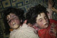 <p>Dead bodies of Syrian kids are seen after Assad regime forces allegedly conducted poisonous gas attack to Douma town of Eastern Ghouta in Damascus, Syria on April 8, 2018. (Photo: Halil el-Abdullah/Anadolu Agency/Getty Images) </p>