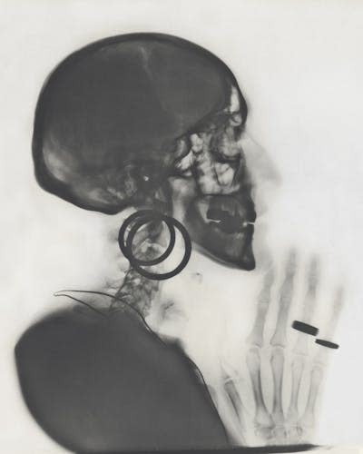 Una radiografía de una cabeza, un torso y unas manos en la que la persona lleva pendientes y anillos.