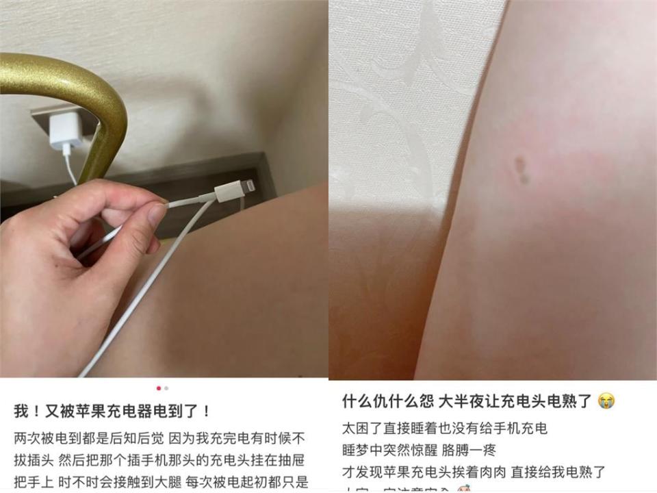 iPhone充電線狂電人！蘋果客服曝1關鍵：一點點麻屬正常情況