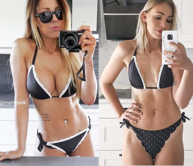 Influencer Says She's 'Proud' After Having Breast Implants Removed: 'I Feel  Like the Real Me