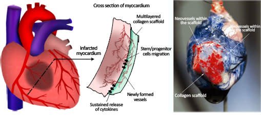 “It has been shown that grafting biocompatible patches onto the infarcted myocardium can improve cardiac tissue repair post ischemia.” (Credit: <a href="http://med.stanford.edu/ruizlozanolab/" rel="nofollow noopener" target="_blank" data-ylk="slk:Stanford School of Medicine;elm:context_link;itc:0;sec:content-canvas" class="link ">Stanford School of Medicine</a>)