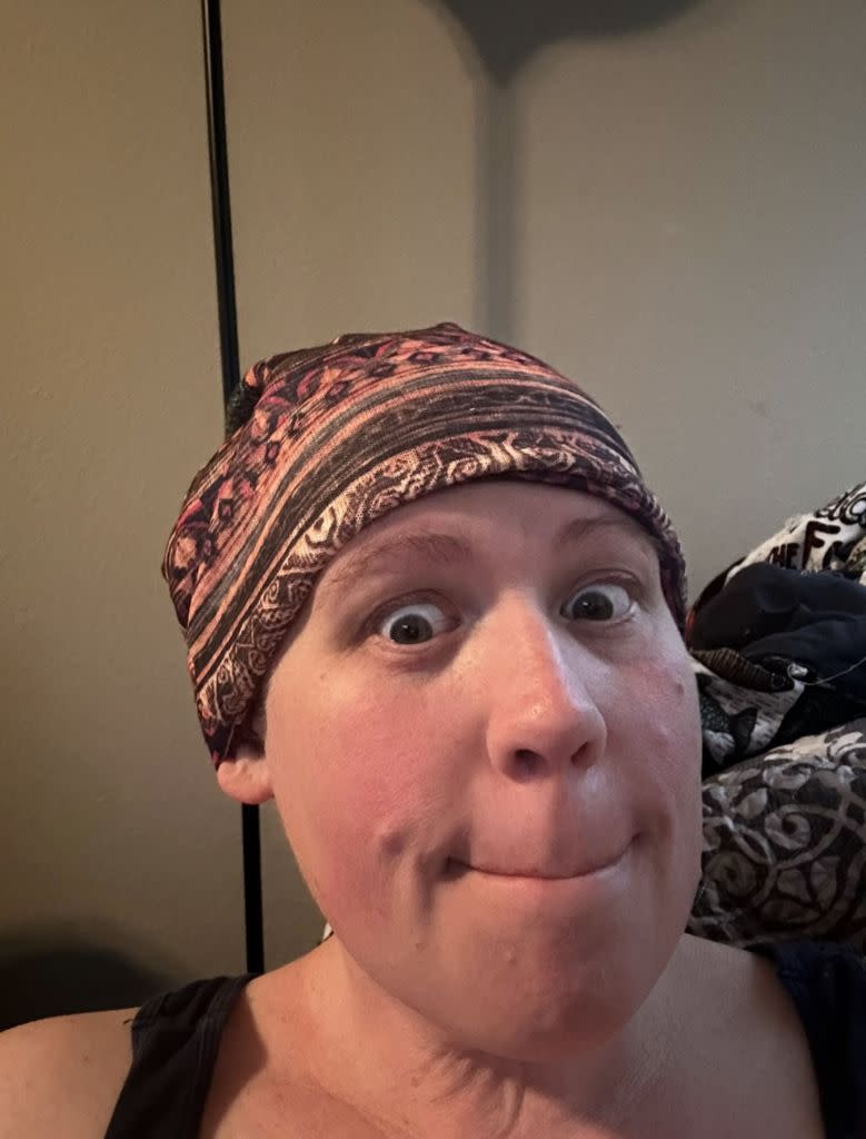 Lisa Monk endured multiple rounds of grueling chemotherapy before being told she never had cancer to begin with. Kennedy News/ Lisa Monk