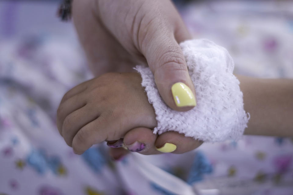 A nurse holds the hand of Karina Andreiko, a 5-year-old Ukrainian girl, as she is prepped for heart surgery by a team led by Dr. Sagi Assa, head of invasive pediatric cardiology, from the Save A Child's Heart non-profit organization, at the Wolfson Medical center in Holon, near Tel Aviv, Israel, Monday, May 2, 2022. Andreiko, received treatment in Israel for a heart defect that she would not have in her war-ravaged home country. (AP Photo/Ariel Schalit)