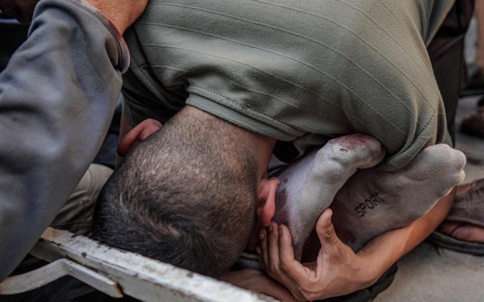 A Palestinian man hugs the feet of a victim of Israeli bombardment in Maghazi,