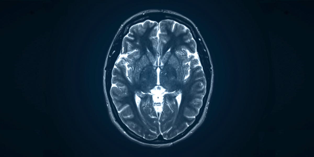 A photo of a brain scan