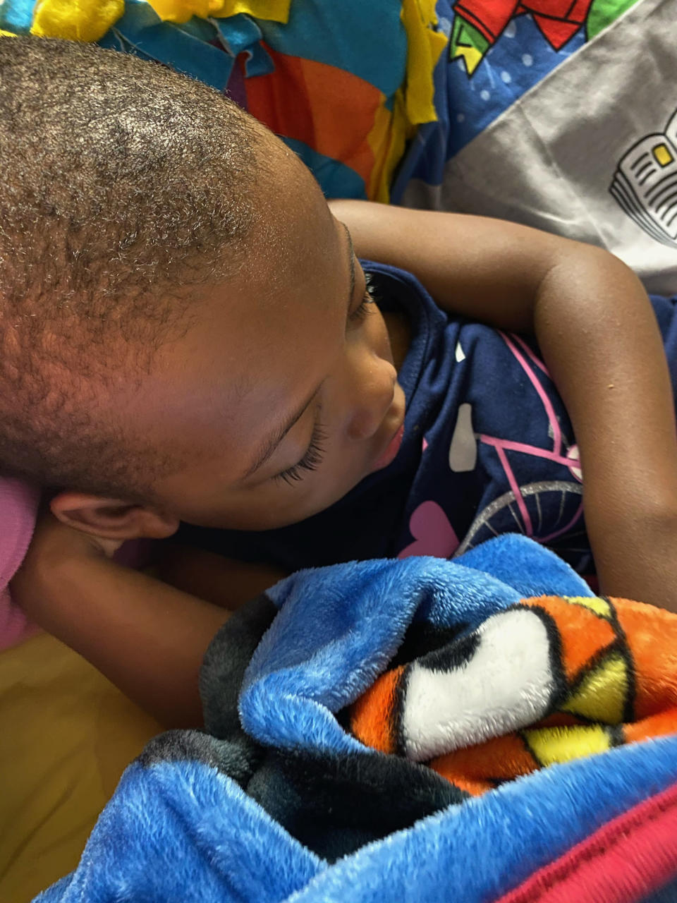 Zion Hicks, age 4, after her bone marrow transplant (Courtesy Sara Hicks)