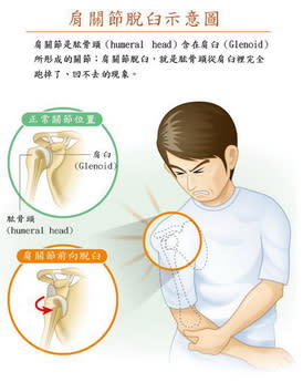 關節脫臼時不要亂動，應就醫由醫師協助復位。