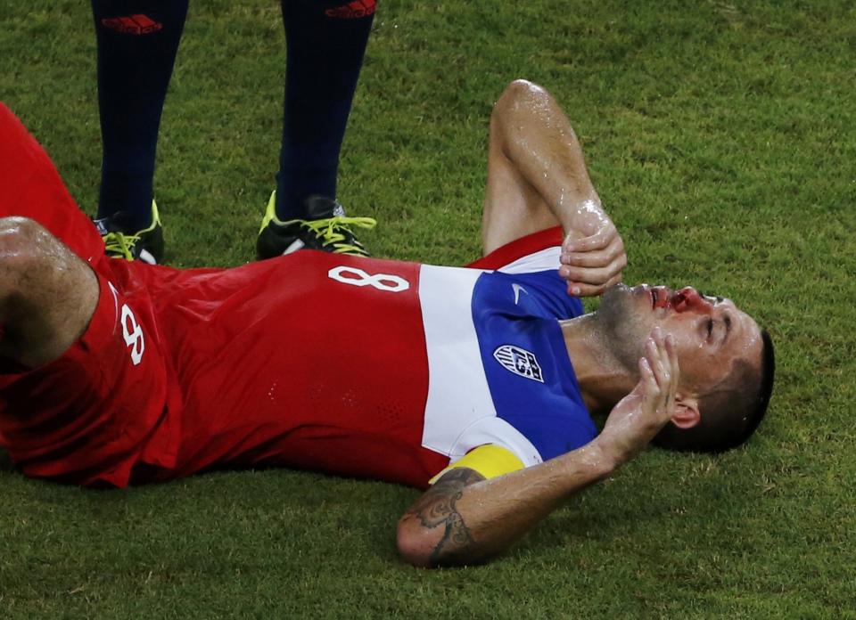 Dempsey of the U.S. lies on the pitch injured after being knocked in the face by Ghana's Boye