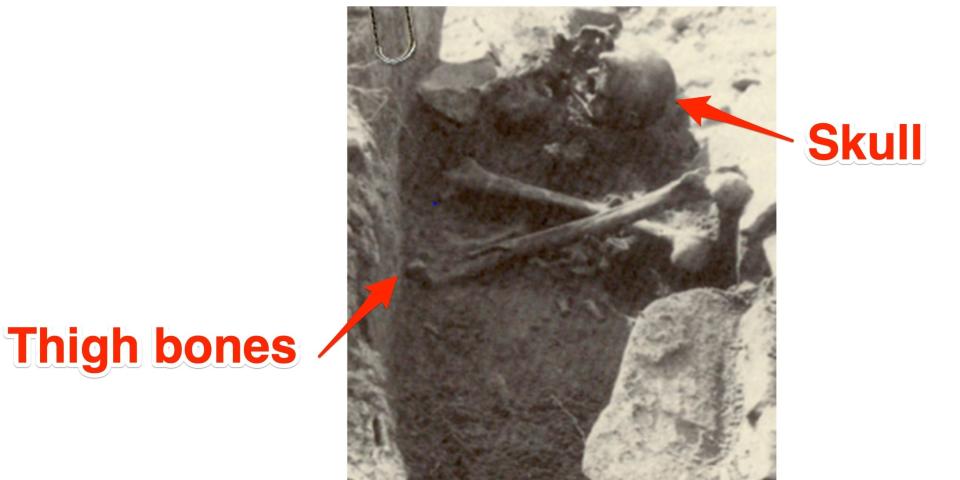 A black and white picture show a skull facing down and to femurs crossed against the "Connecticut vampire's" chest in the grave.