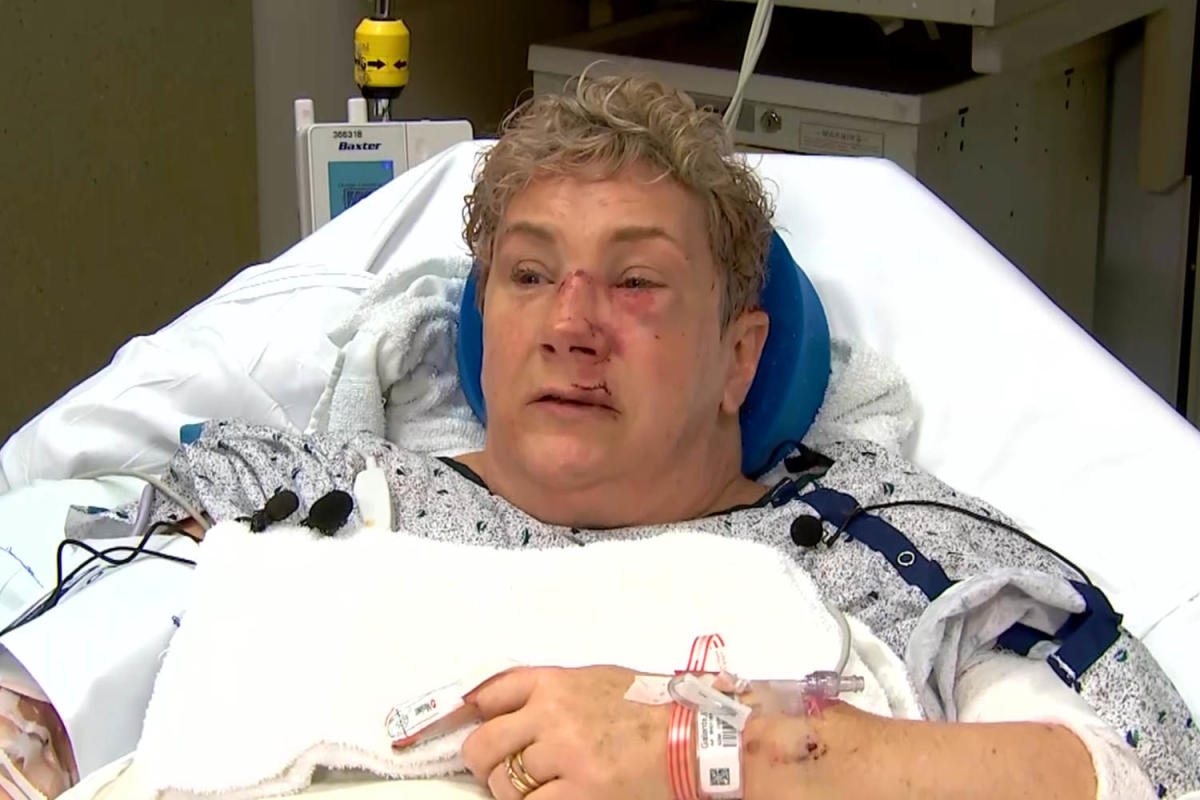 Miraculous Survival: Pennsylvania Woman Attacked by Bear While Letting Dog Out