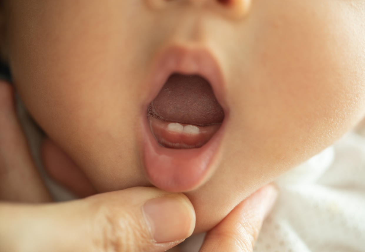 When should a baby visit the dentist for the first time? Yahoo Life asked experts (and parents) for their tips for visiting the dentist with young kids. (Photo: Getty Creative)