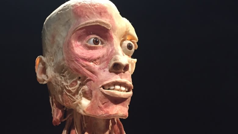 Calgary 1st city in Canada and U.S. to exhibit Body Worlds 'coupling' specimen