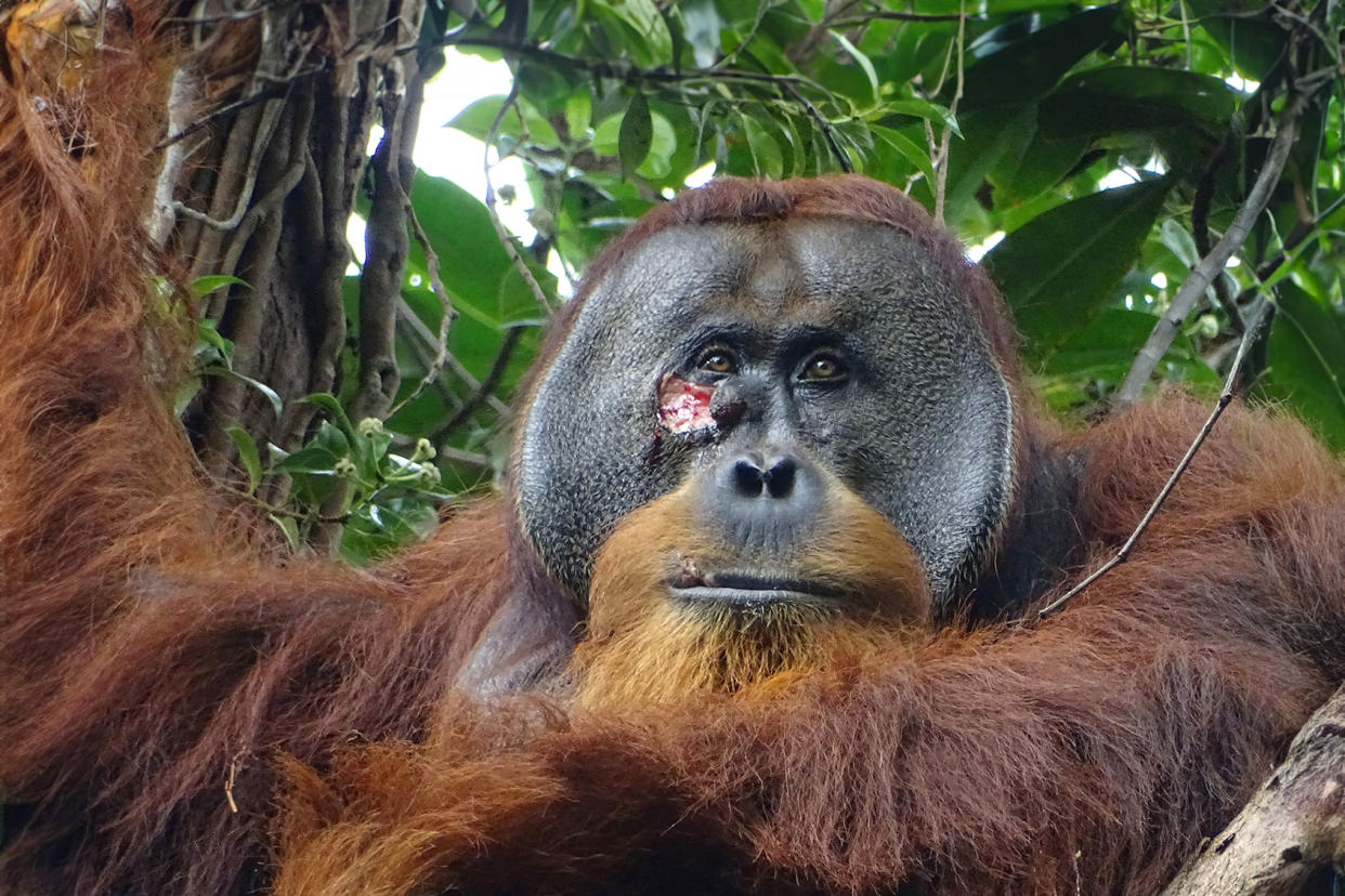 Injured male orangutan SUAQ Foundation/AFP via Getty Images