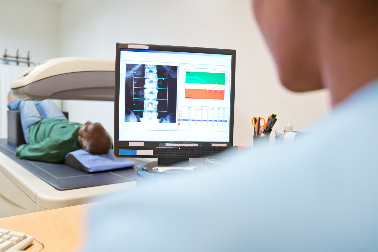 Bone Density Test