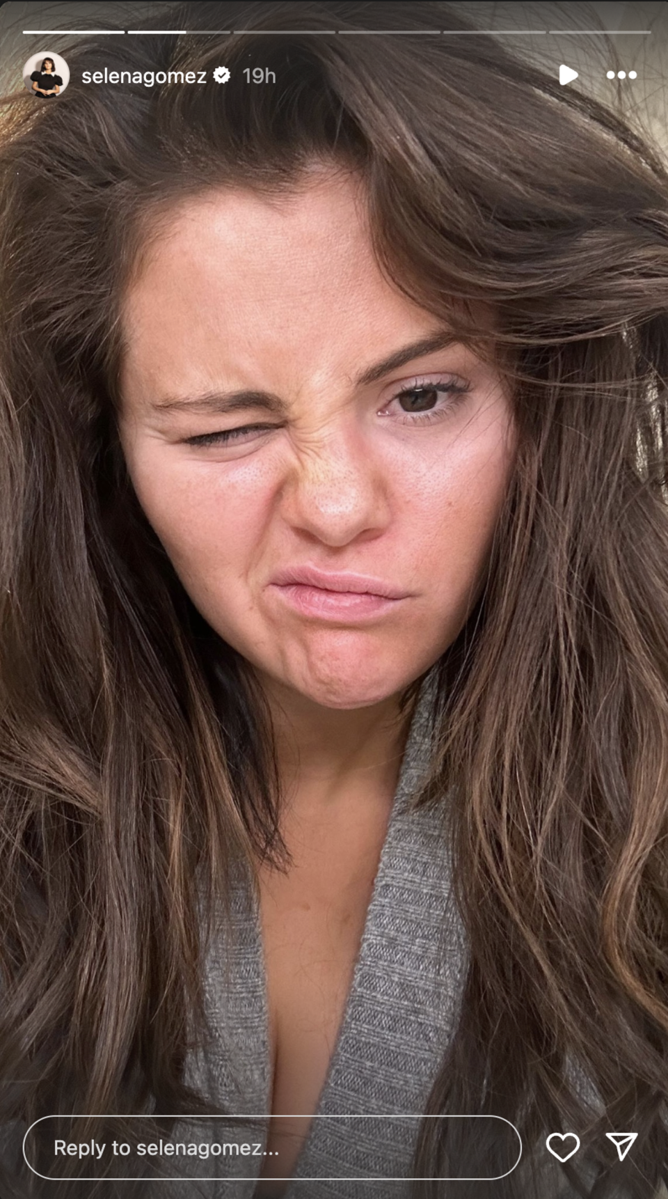 Selena Gomez shares a close up shot wearing no makeup.