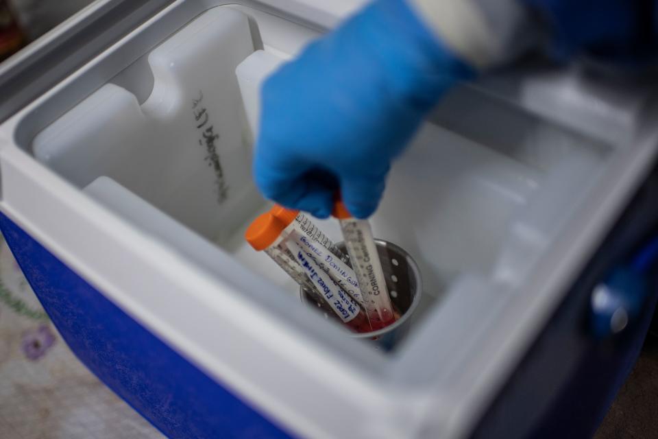 A health worker stores a test while on door-to-door visits to carry out COVID-19 tests in Mexico City, on June 16, 2020, amid the new coronavirus pandemic. (Photo by PEDRO PARDO / AFP) (Photo by PEDRO PARDO/AFP via Getty Images)