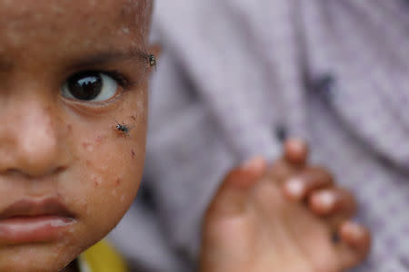 Flies sit on the face of a girl as Rohingya refugees wait for some aid to be distributed at a camp for those who recently fled from Myanmar, near Cox's Bazar, Bangladesh October 8, 2017. REUTERS/Damir Sagolj