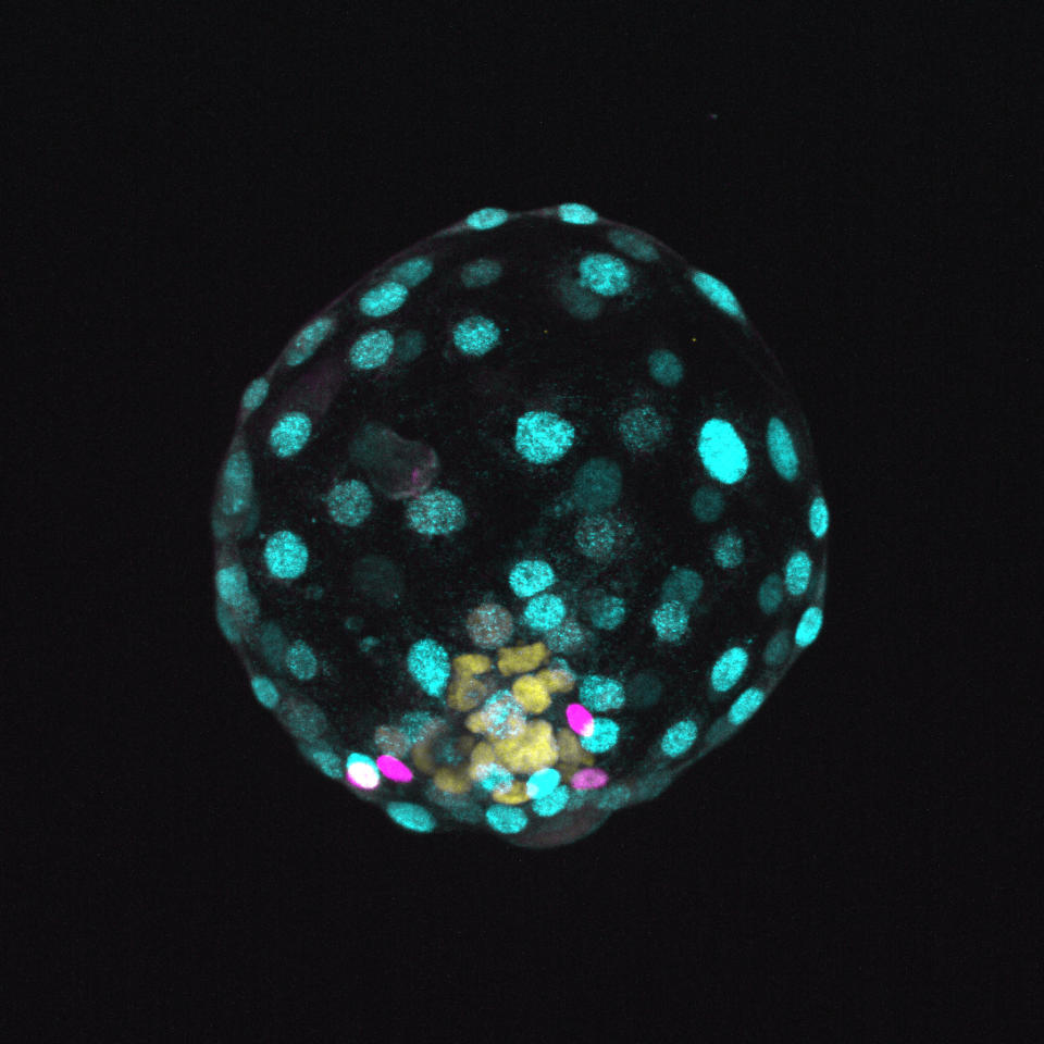This image, provided by the Institute of Molecular Biology of the Austrian Academy of Sciences, shows a human “blastoid” created in a lab. A new study in Nature on Thursday, Dec. 2, 2021, shows how scientists created this structure that mimics a blastocyst, a ball of cells that form within a week of fertilization, and can be used in research. (Photo by Alok Javali, Heidar Heidari and Theresa Sommer/Institute of Molecular Biology of the Austrian Academy of Sciences via AP)