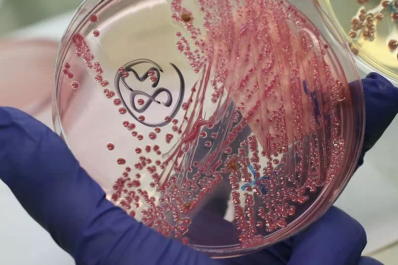 A bacteria culture infected with E. coli